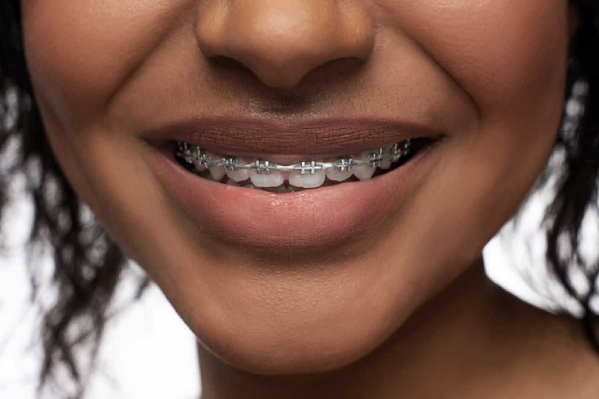 Dental services